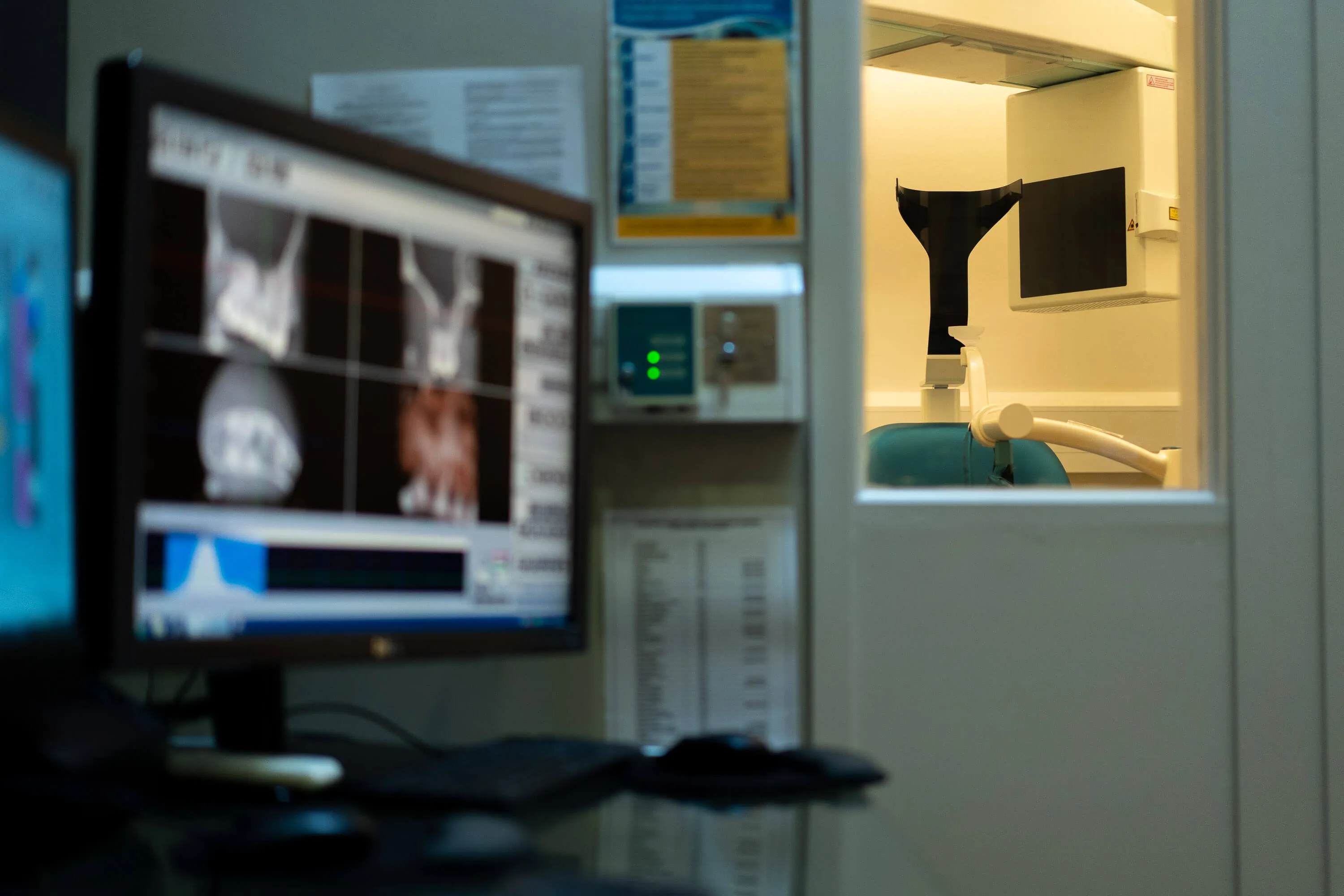 Cone beam CT imaging workstation used for diagnosis and treatment planning