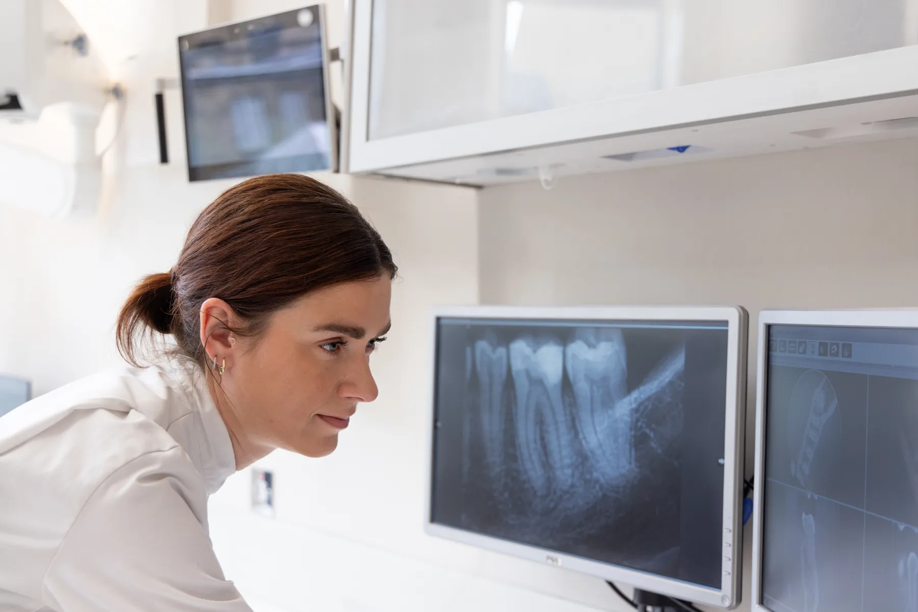 Reviewing radiographs during endodontic diagnosis